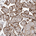 Immunohistochemical staining of human placenta shows moderate cytoplasmic positivity in trophoblastic cells.