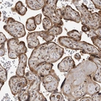 Immunohistochemical staining of human placenta shows moderate cytoplasmic positivity in trophoblastic cells.