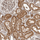 Immunohistochemical staining of human kidney shows strong cytoplasmic positivity in cells in tubules.