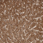 Immunohistochemical staining of human liver shows strong cytoplasmic positivity in hepatocytes.