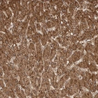Immunohistochemical staining of human liver shows strong cytoplasmic positivity in hepatocytes.