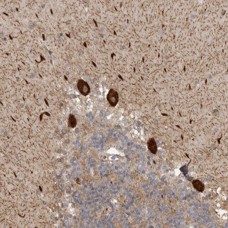 Anti-DNAH14 Antibody