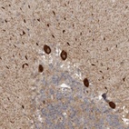 Anti-DNAH14 Antibody