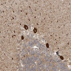 Anti-DNAH14 Antibody