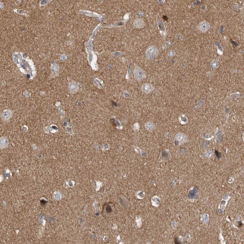 Anti-PPP1R9A Antibody