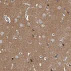 Anti-PPP1R9A Antibody