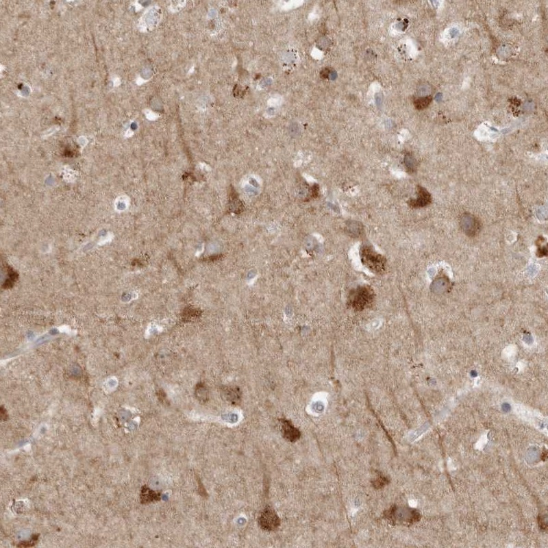 Anti-TNFRSF11A Antibody