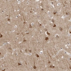 Anti-TNFRSF11A Antibody