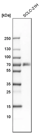 Western blot analysis in human cell line SCLC-21H.