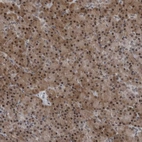 Anti-AKR1A1 Antibody