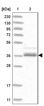 Lane 1: Marker [kDa] 230, 130, 95, 72, 56, 36, 28, 17, 11_br/_Lane 2: Human cell line RT-4