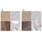 Immunohistochemical staining of human cerebral cortex, liver, lymph node and testis using Anti-DBNL antibody HPA027735 (A) shows similar protein distribution across tissues to independent antibody HPA020265 (B).