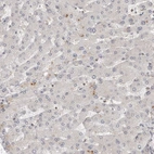 Immunohistochemical staining of human liver shows low expression as expected.