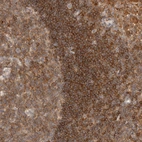 Immunohistochemical staining of human lymph node shows high expression.