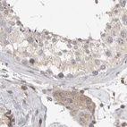 Immunohistochemical staining of human testis using Anti-DBNL antibody HPA027735.