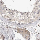 Immunohistochemical staining of human testis using Anti-DBNL antibody HPA027735.
