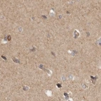 Immunohistochemical staining of human cerebral cortex using Anti-DBNL antibody HPA027735.