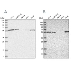 Western blot analysis using Anti-DBNL antibody HPA027735 (A) shows similar pattern to independent antibody HPA020265 (B).