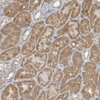 Anti-KYAT1 Antibody