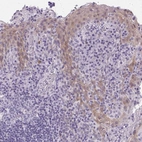 Immunohistochemical staining of human tonsil shows moderate cytoplasmic positivity in squamous epithelial cells.