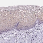 Immunohistochemical staining of human cervix, uterine shows weak cytoplasmic positivity in squamous epithelial cells.
