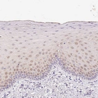 Immunohistochemical staining of human oral mucosa shows weak cytoplasmic positivity in squamous epithelial cells.