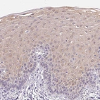 Immunohistochemical staining of human esophagus shows moderate cytoplasmic positivity in squamous epithelial cells.