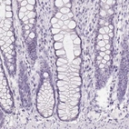 Immunohistochemical staining of human colon shows no positivity in glandular cells as expected.