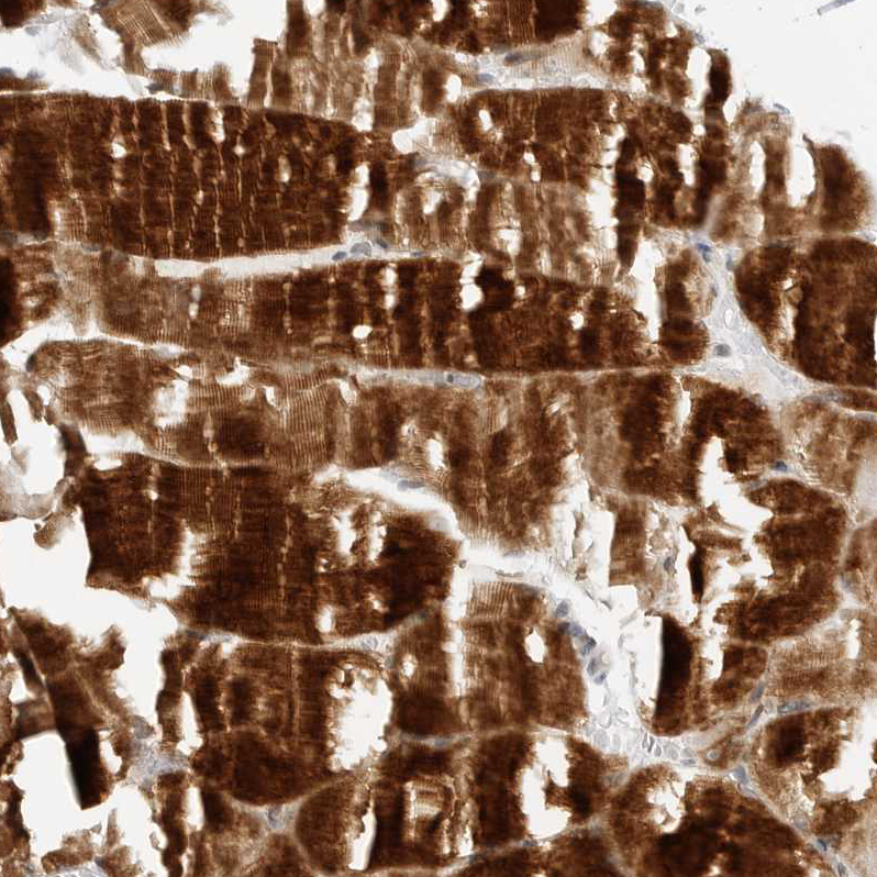 Anti-MAP2K5 Antibody