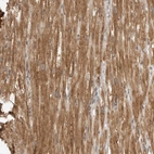 Immunohistochemical staining of human heart muscle shows moderate cytoplasmic positivity in cardiomyocytes.