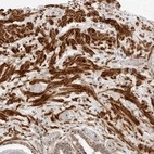 Immunohistochemical staining of human prostate shows strong cytoplasmic positivity in smooth muscle cells.