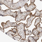Immunohistochemical staining of human placenta shows moderate cytoplasmic positivity in trophoblastic cells.
