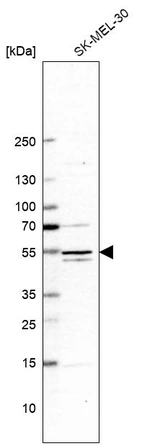 Western blot analysis in human cell line SK-MEL-30.