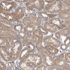Anti-VAC14 Antibody