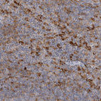 Immunohistochemical staining of human lymphoid tissues shows strong cytoplasmic positivity in non-germinal center cells.