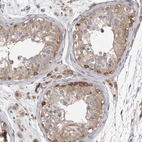 Immunohistochemical staining of human testis shows moderate cytoplasmic positivity in cells in seminiferous ducts.