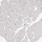 Immunohistochemical staining of human skeletal muscle shows no positivity in myocytes as expected.