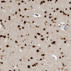 Immunohistochemical staining of human cerebral cortex shows strong nuclear positivity in neurons and glial cells.