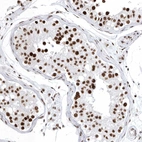 Immunohistochemical staining of human testis shows strong nuclear positivity in cells in seminiferous ducts.