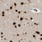 Immunohistochemical staining of human cerebral cortex using Anti-BCLAF1 antibody HPA027770.