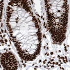 Immunohistochemical staining of human colon using Anti-BCLAF1 antibody HPA027770.