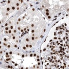 Immunohistochemical staining of human kidney using Anti-BCLAF1 antibody HPA027770.