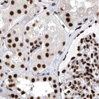 Anti-BCLAF1 Antibody
