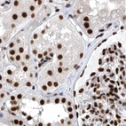Immunohistochemical staining of human kidney using Anti-BCLAF1 antibody HPA027770.