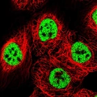 Immunofluorescent staining of human cell line A-431 shows localization to nuclear speckles.