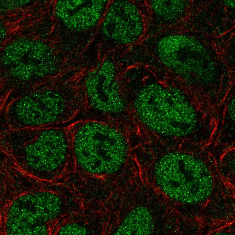 Anti-TRERF1 Antibody