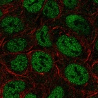 Anti-TRERF1 Antibody