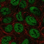 Anti-TRERF1 Antibody