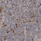 Immunohistochemical staining of human tonsil shows moderate to strong cytoplasmic positivity in lymphoid cells.