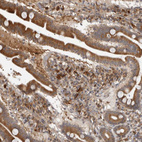 Immunohistochemical staining of human small intestine shows moderate to strong cytoplasmic positivity in lymphoid cells.